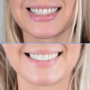 Dr.Klīnika zobu implanti