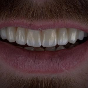 Dr.Klīnika zobu implanti