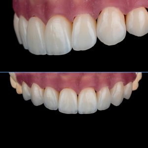 DR Klīnika ortodontija un 8 keramiskās restaurācijas