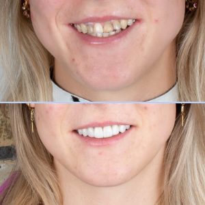 DR Klīnika ortodontija un 8 keramiskās restaurācijas